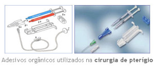 Cirurgia de Pterígio - Modernas Técnicas