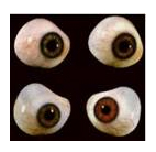Cirurgia Plástica Ocular: Oculoplástica
