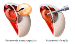 Facetomia