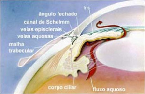  Glaucoma de ângulo fechado